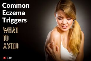 Common Eczema Triggers to Avoid