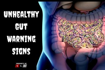 Unhealthy Gut Warning Signs